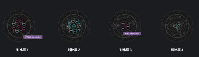 CaliberMRI 206单壁乳腺体模,CaliberMRI 206乳腺MRI定量体模